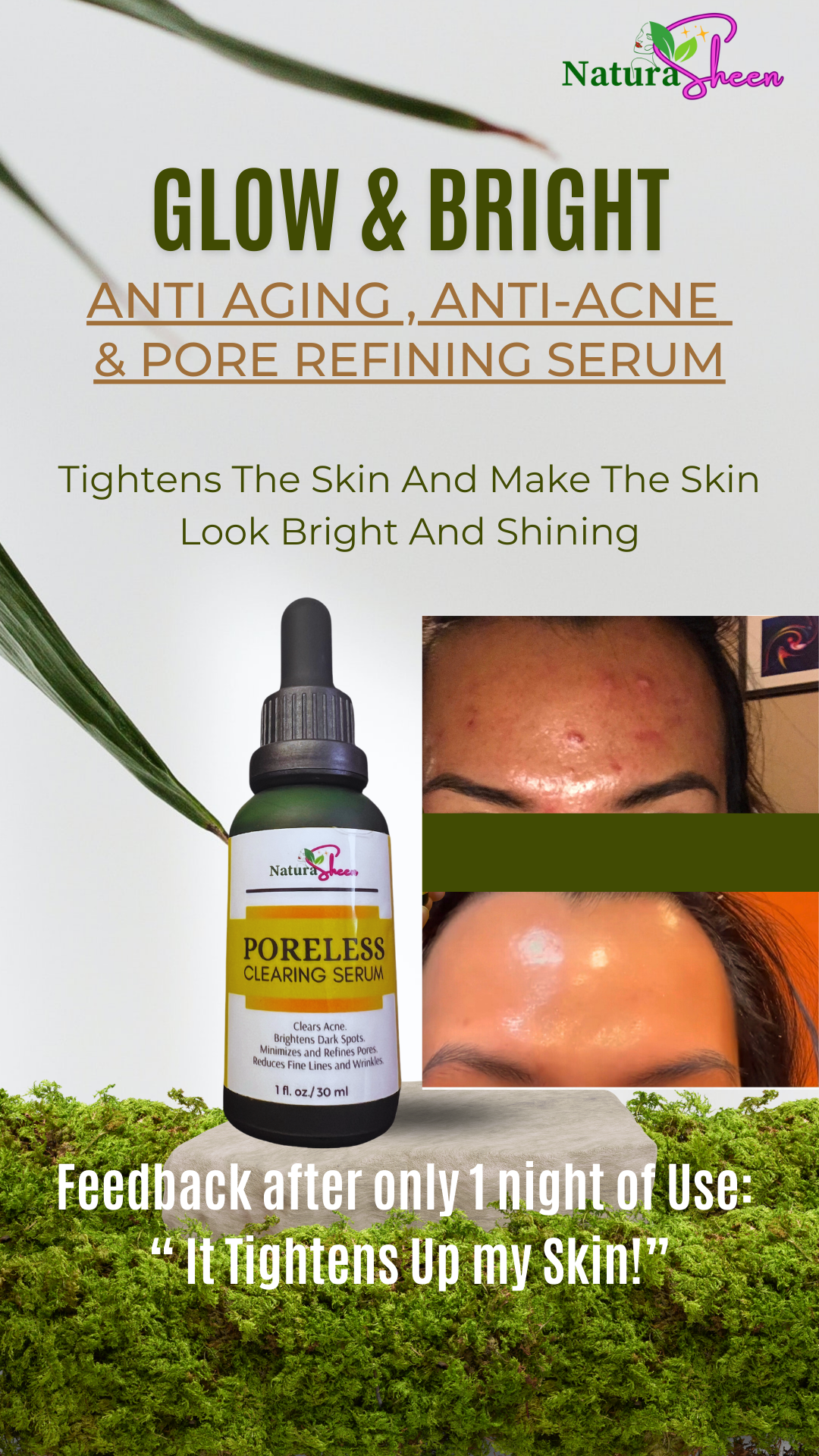 PORELESS CLEARING SERUM 1oz/30ml
(Tighten Skin, Shrink Pores, Clears Acne, helps remove dark spots and blemishes, reduce fine lines and wrinkles)