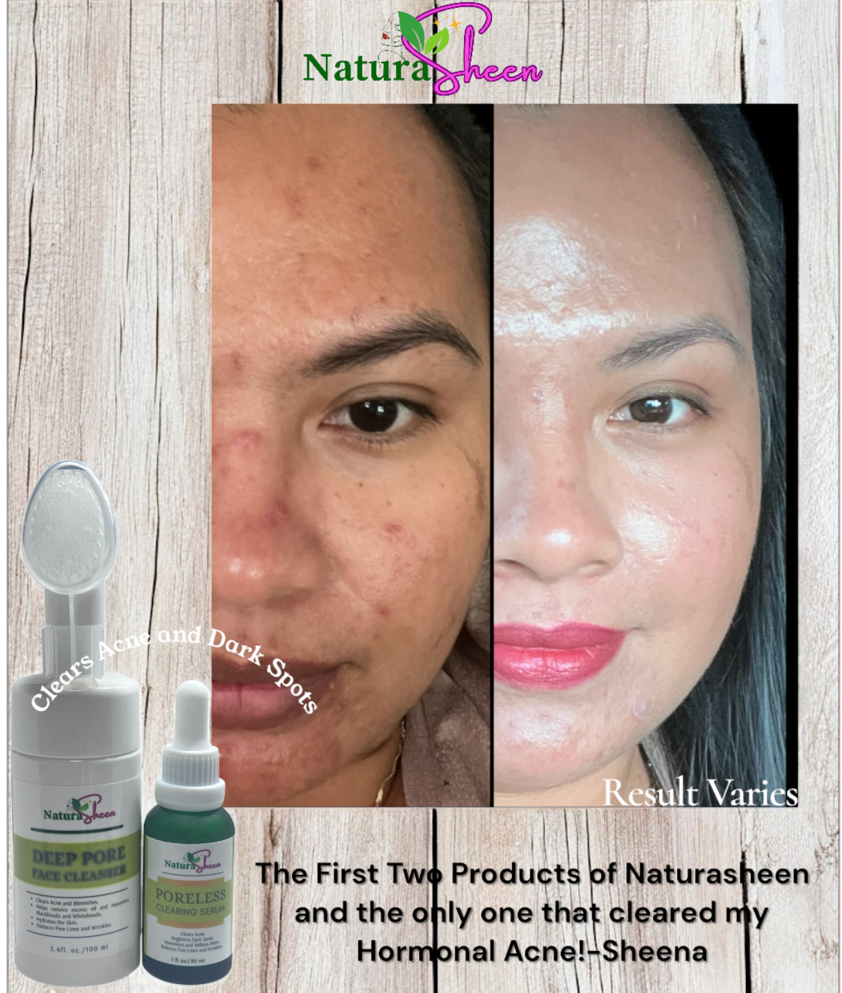 Clear Skin Duo for Acne, Dark Spot, Dull Skin, Large Pores, Fine Lines